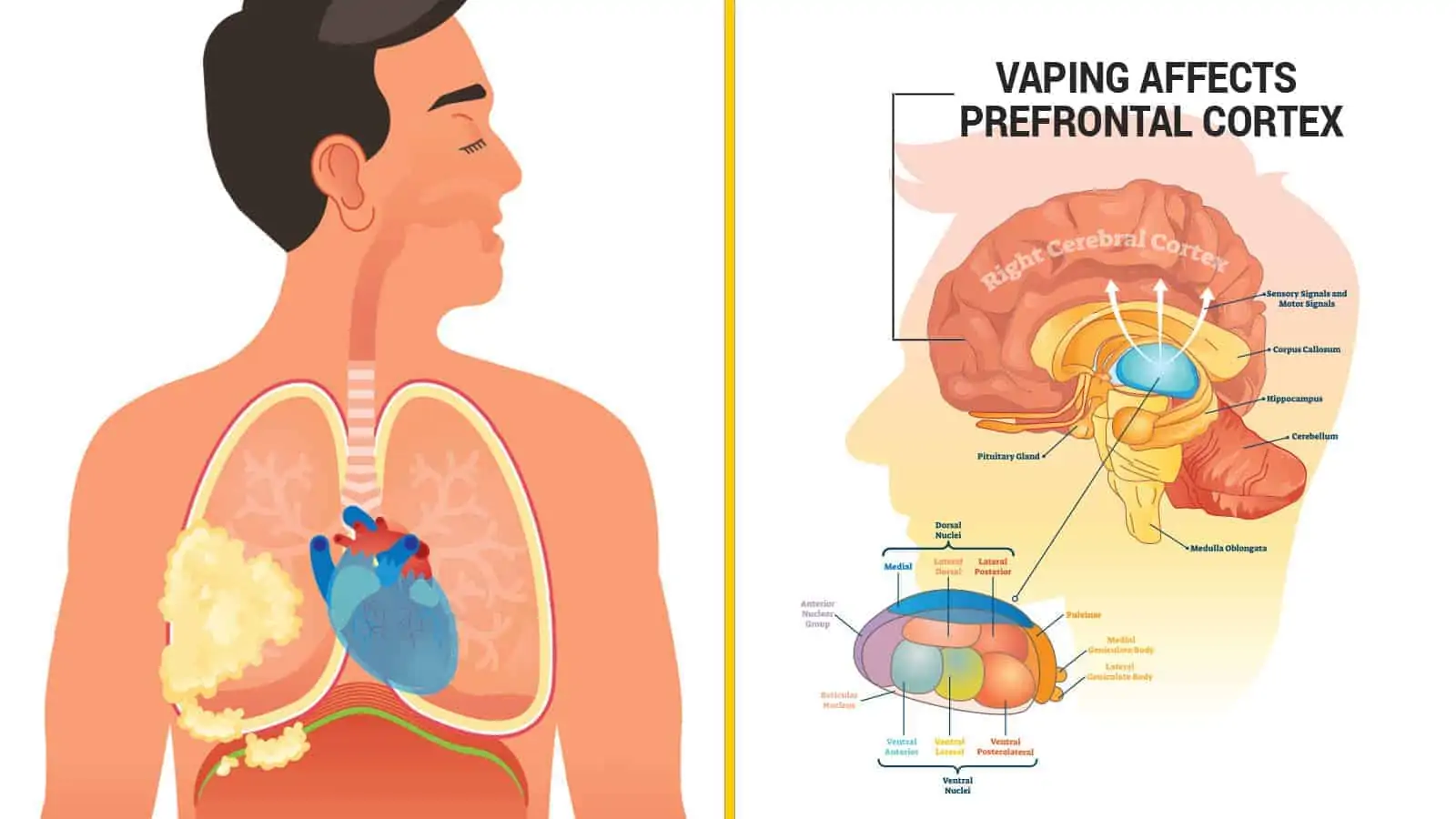 nicotine vape
